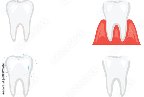 Tooth Health and Gum Condition Illustration Set with Clean Tooth Sensitive Tooth and Inflamed Gums for Dental Healthcare Education Design