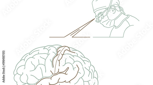 A skilled neurosurgeon wearing specialized magnifying loupes and surgical scrubs performs a delicate procedure on a detailed anatomical map of the brain.