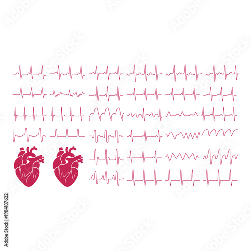 Electrocardiogram readings with anatomical images of the human heart