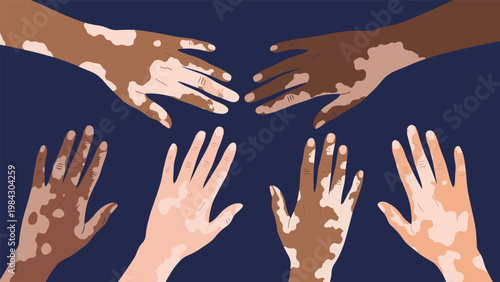 Multiple hands of various skin tones with vitiligo reach toward each other against a dark background to symbolize skin health and diversity.
