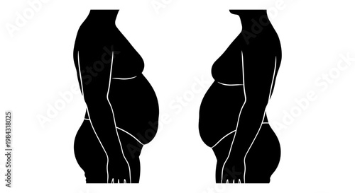 Comparison of body fat distribution between two human figures from the back view Vector, illustration