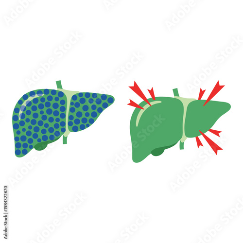 Comparison of healthy liver and liver with damaged sections highlighted Vector, illustration