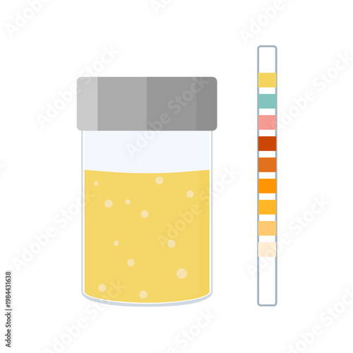 Urine sample cup and urinalysis reagent strip for kidney exam, urinary tract infection and cystitis diagnostics. Ketone and PH rapid test strips for ketogenic and alkaline diets. Vector illustration.