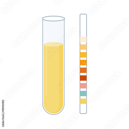 Urine sample tube and urinalysis reagent strip for kidney exam, uti and cystitis diagnostics. Ketone and PH rapid test strips for ketogenic and alkaline diets. Medical vector illustration.