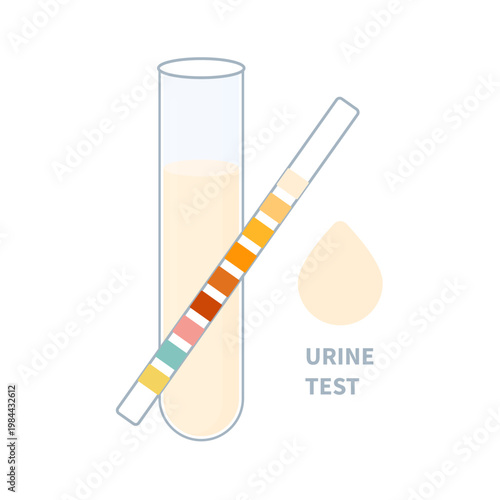 Urine sample tube and urinalysis reagent strip for kidney exam, uti and cystitis diagnostics. Ketone and PH rapid test strips for ketogenic and alkaline diets. Medical vector illustration.