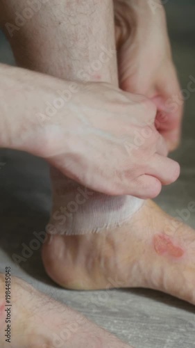Close up man carefully wrapping white sterile gauze bandage around his injured ankle after trauma, providing first aid treatment for wound, or burn at home. Vertical. Man bandaging burns on leg.