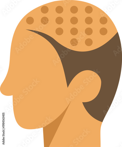Human head illustrating hair transplantation process with follicles on scalp