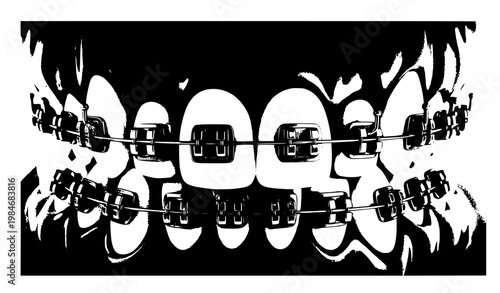 Teeth with dental braces outline vector icon set on white background