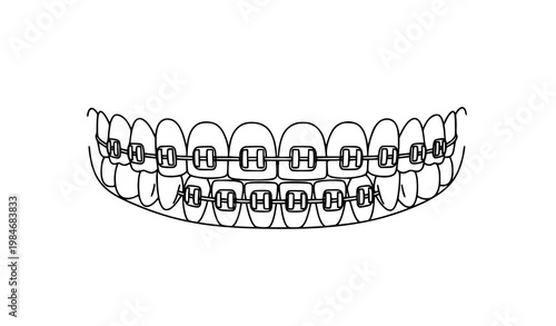Dental braces on teeth outline vector illustration isolated on white background