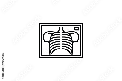A simplified line drawing depicts a chest x ray displayed on a monitor screen