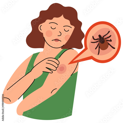 Tick Bite on Human Skin. Flat vector illustration of woman with tick bite and irritation, Lyme disease risk concept. Perfect for healthcare, medical education and outdoor safety design.