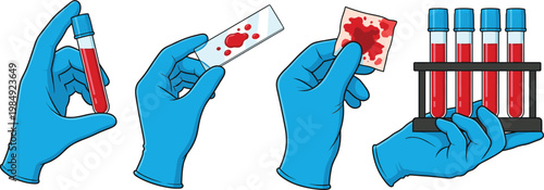 Gloved Hands Holding Blood Samples in Test Tubes and Glass Slides for Laboratory Analysis, Flat Vector Illustration