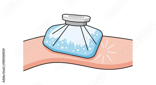 Close-up of a translucent blue ice pack with condensation, applied to a human arm, depicting relief from pain or injury with radiating white lines, clean vector art style.