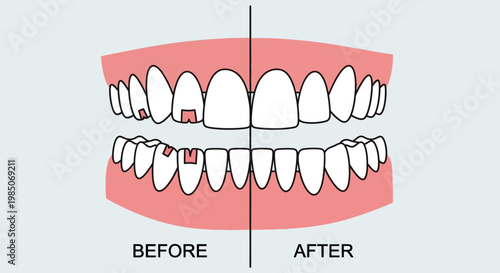 Before and After Dental Restoration Comparative visual depicting chipped, broken teeth on the left contrasted with perfectly restored, healthy enamel on the right.