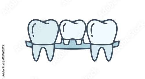 Stylized, minimalist vector graphic depicting a dental bridge with three light blue crowns supported by a metallic structure, representing dental restoration and oral health concepts.