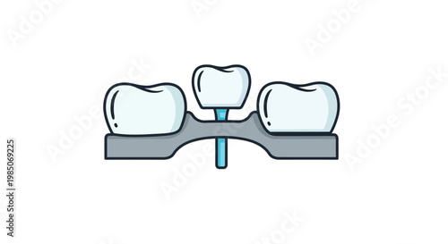 Simplified vector graphic showcasing a dental implant supporting a crown between two adjacent teeth, presented in a clean, modern, and conceptual flat art style.