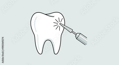 Clean, modern, vector graphic of a healthy white tooth receiving dental laser treatment for professional cleaning and whitening, with light rays emitting.