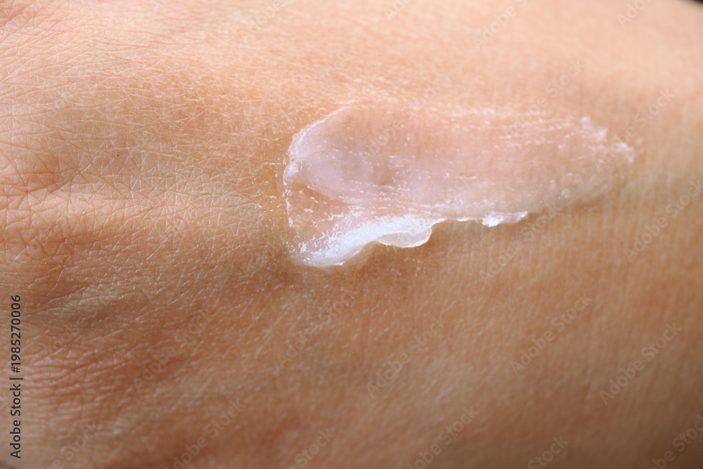 Fototapeta premium petroleum jelly applied to skin on hand in morning light