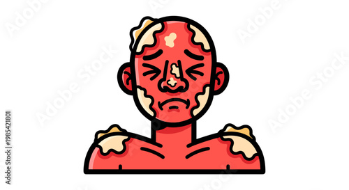 Illustration of a person with red skin experiencing peeling, showing discomfort, bold outlines, white background