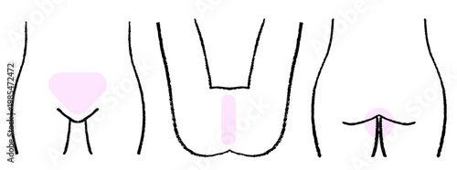 脱毛 VIOセット 手書き