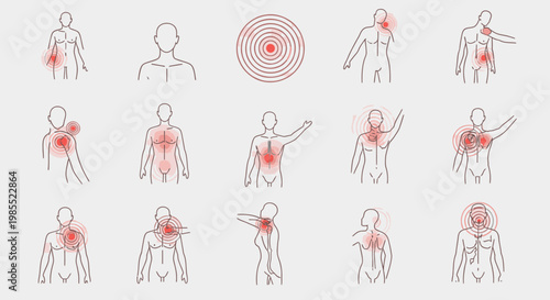 Human body pain points and radiating discomfort areas illustrated with red circles on various anatomical figures.