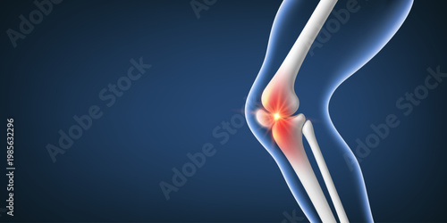 Knee joint pain and inflammation concept. Medical anatomy of human leg. Realistic vector illustration