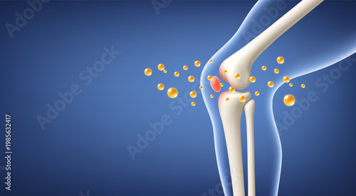 Knee joint pain relief with active nutrient. Inflammation and joint support concept. Realistic medical vector illustration