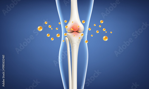 Knee joint pain relief with active nutrient. Inflammation and joint support concept. Realistic medical vector illustration