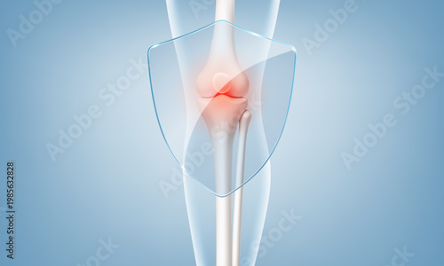 Knee joint protection concept with transparent shield. Arthritis pain and orthopedic healthcare. Realistic vector illustration