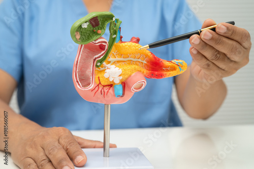 Liver with gallbladder, pancreas spleen and duodenum, Asian doctor holding human anatomy model for study diagnosis and treatment in hospital.