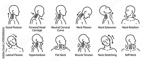 Human neck postures, movements, and common conditions are illustrated in this educational diagram showing various anatomical positions.