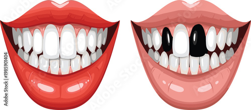 Cartoon Smiling Mouth Set Showing Healthy White Teeth and Decayed Black Tooth Dental Health Comparison Vector Illustration