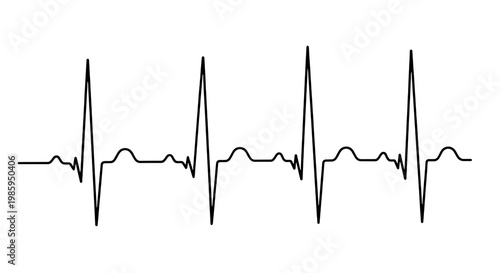 Graphic representation of a heartbeat using an electrocardiogram (ecg) waveform pattern isolated on transparent background