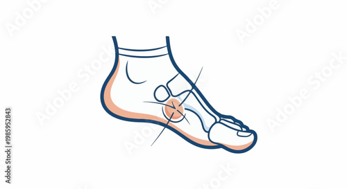 Anatomical illustration of a painful foot with highlighted joint pain