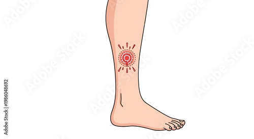 Human leg with a red circular rash or insect bite on the skin demonstrating common dermatological symptoms or allergic reactions.
