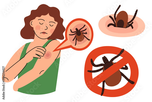 Tick Bite and Warning Concept Set. Flat vector illustration of tick bite symptoms, parasite close up and prohibition sign, Lyme disease awareness for medical and healthcare design.