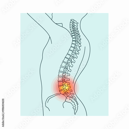 Medical illustration of a human spinal column side profile showing the cervical, thoracic, and lumbar regions with a red glow indicating lower back pain or lumbar inflammation.
