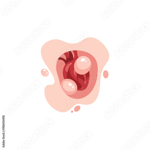 Medical vector illustration showing lipid buildup and cholesterol plaque within a blood vessel or artery, representing cardiovascular health, heart disease, and circulatory system.
