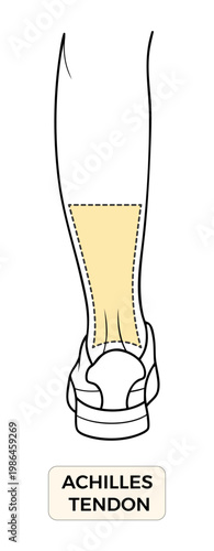 Achilles Tendon Anatomy Diagram, Heel Tendon Pain Location Medical Illustration