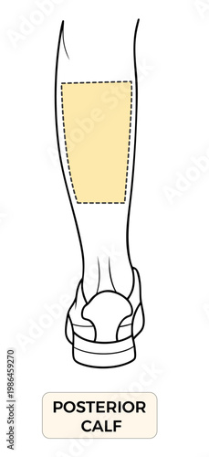 Posterior Calf Anatomy Diagram, Back Lower Leg Pain Area Medical Illustration