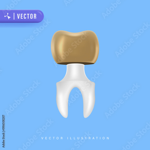 Dental Crown Treatment Concept with Tooth Illustration Featuring Gold Crown Restoration and Professional Dentistry Care