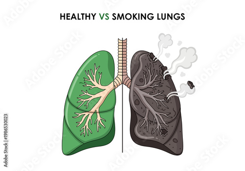 Vector illustration of healthy lungs vs smoking lungs, showcasing the detrimental effects of tobacco use