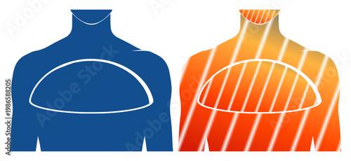 Abstract representation of two human torsos, one blue and one orange with stripes, highlighting internal chest area.