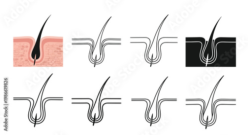 Detailed vector illustration set of human hair follicles in various styles for educational and medical graphic designs.
