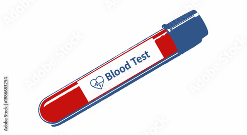 Blood test tube with label.