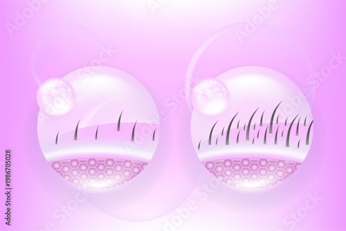 Hyaluronic acid and Niacinamide before and after hair and skin solutions ad. pink collagen serum drop into skin cells with cosmetic advertising background ready to use, illustration vector.