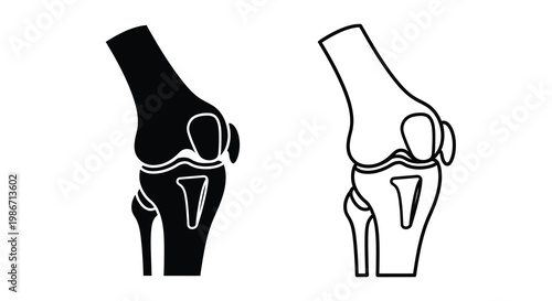 Anatomical illustration depicting a human knee joint in contrasting views