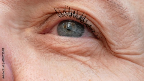 middle aged female's eye with drooping eyelid. Ptosis is a drooping of the upper eyelid, lazy eye. Cosmetology and facial concept, first wrinkles