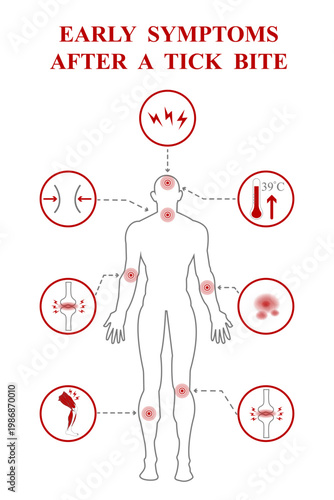 Infographic showing early symptoms after tick bite with human body silhouette and circular icons indicating rash, fever, headache, fatigue and joint pain on white background.