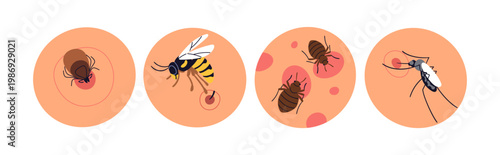 Insect bites set. Ticks, mites, bee with sting, bed bugs and mosquito. Red marks and spots, allergy, rash, redness on skin after bloodsuckers. Flat vector illustrations isolated on white background